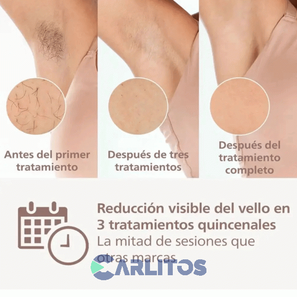 Depiladora Philips Lumea Prestige Bri947/30