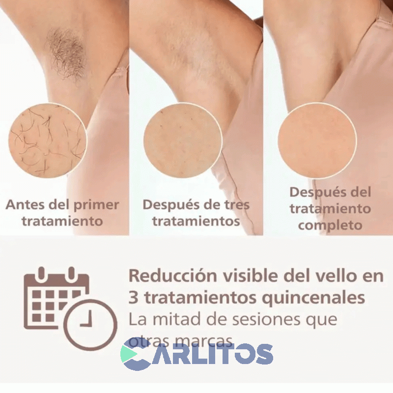 Depiladora Philips Lumea Prestige Bri947/30